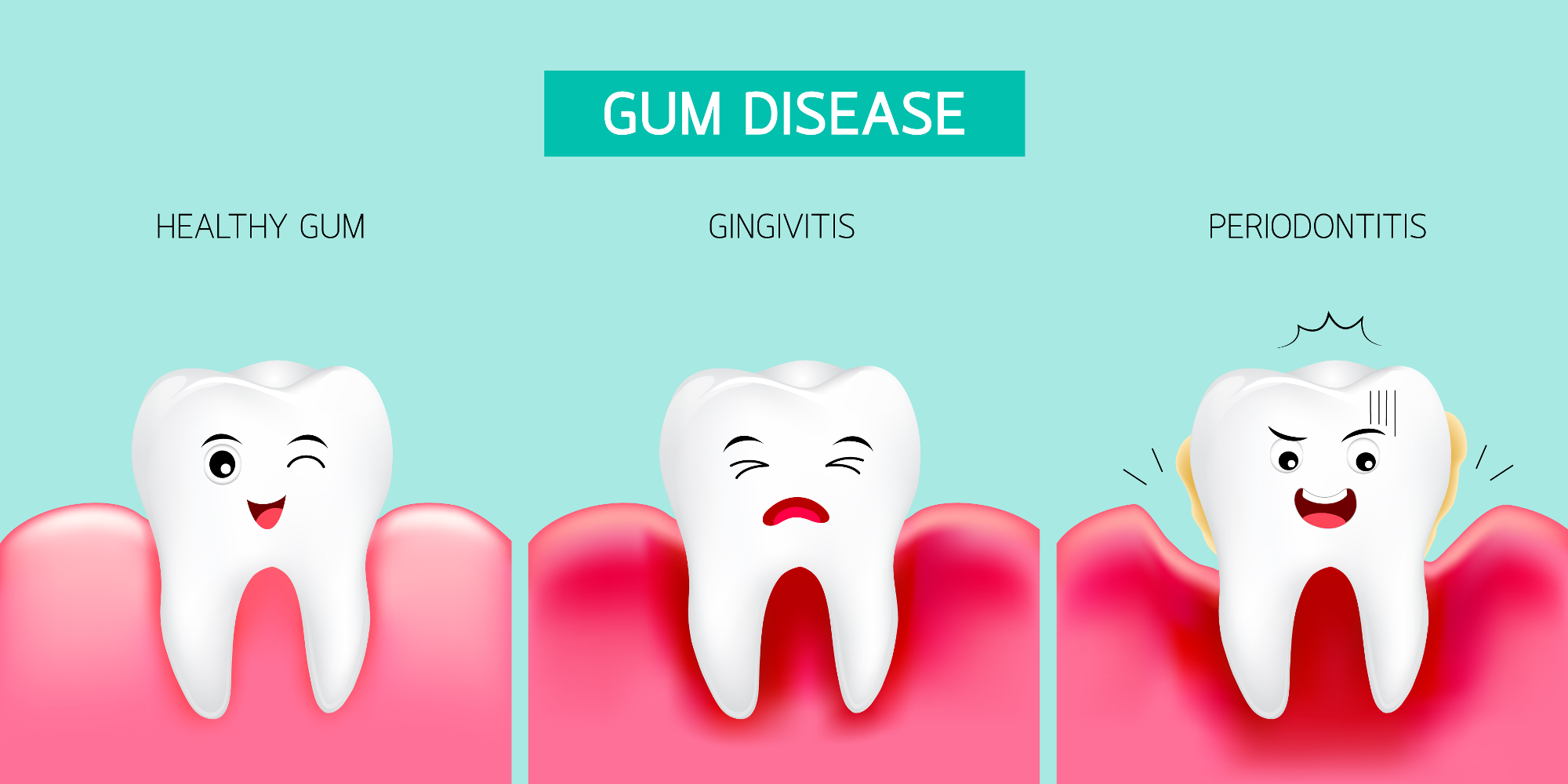 Prevention of Gum Diseases: An Overview
